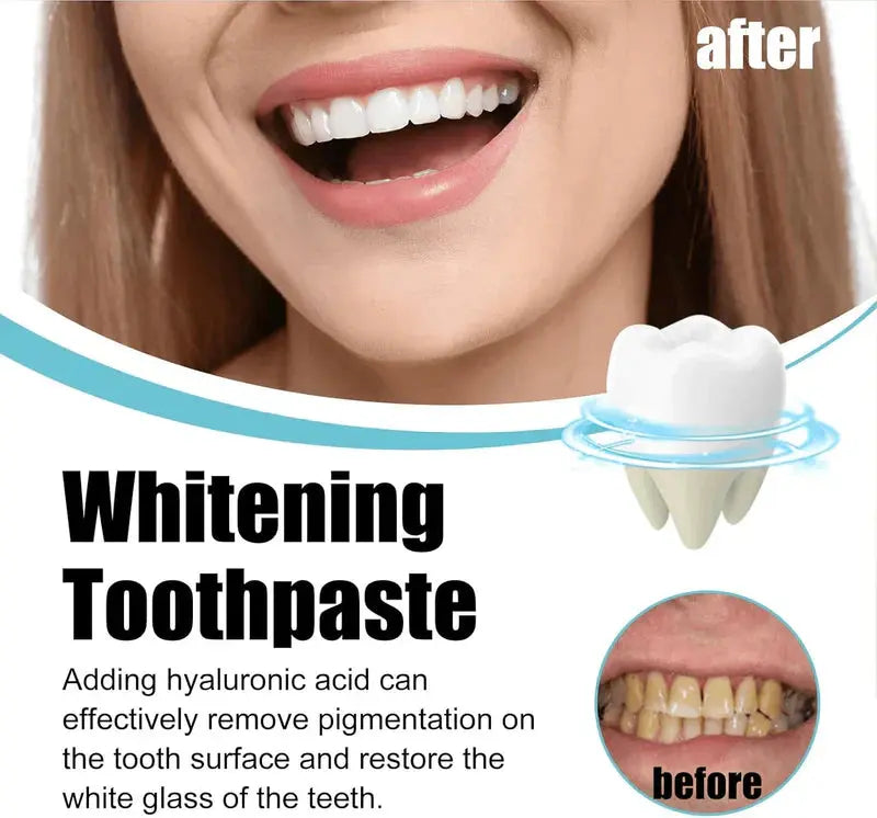 Scoban - Teeth Whitening (Original) My Store